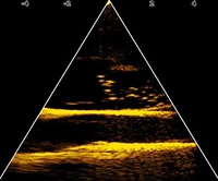 A Lowrance Eagle széria, és a csúcsán az Eagle Eye